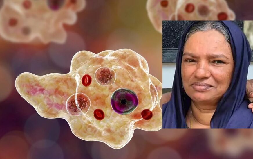 അമീബിക് മസ്‌തിഷ്‌ക ജ്വരം; ഒന്നരമാസത്തോളം ചികിത്സയിലായിരുന്ന സ്ത്രീ മരിച്ചു